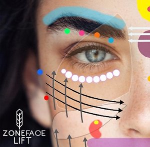 Zone Face Lift. Zone Face Lift